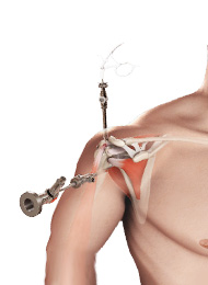 Open and Arthroscopic Shoulder Surgery