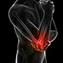 Elbow Impingement